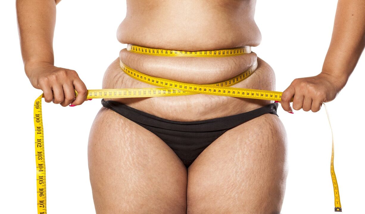 Excess weight and weight loss using zxcvbnmqwert